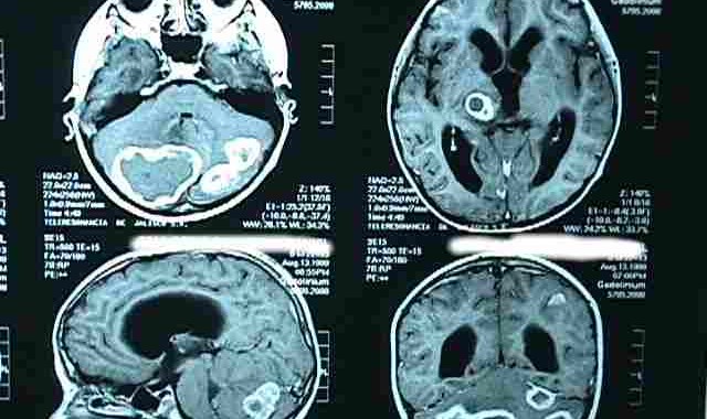 Neurofisiología clínica